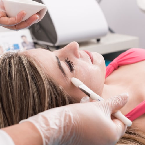 Chemical Peels